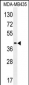 LILRA5 Antibody (N-term)